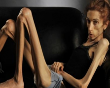 世界上最瘦的女孩体重很吓人 一起来看看到底有多