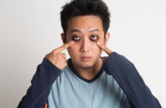 黑眼圈是怎么回事 黑眼圈是哪些疾病的信号