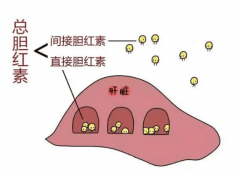 什么原因导致胆红素过高 胆红素高有什么危害