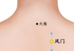 刮痧的注意事项有哪些 刮痧可以帮助退烧吗