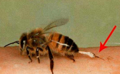 蜜蜂蛰了怎么办 被蜂蛰伤后的急救方法