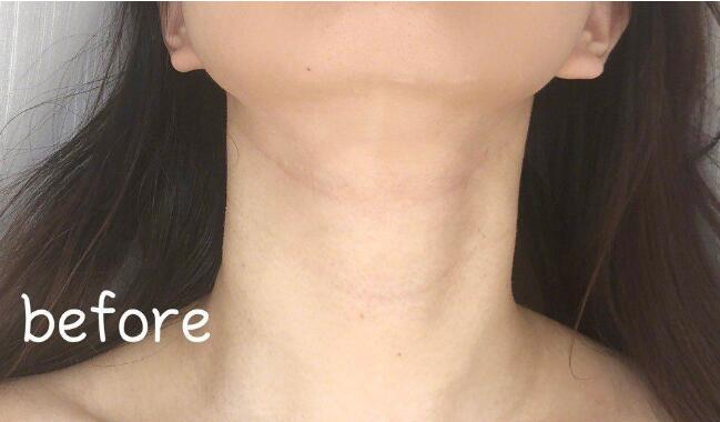 颈纹淡化按摩方法 坚持一周就可以明显看到颈纹淡