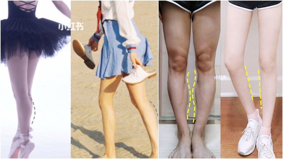 腿粗还分「脂肪型、水肿型」？ 不同腿搭配不同运动，1周速成腿精～
