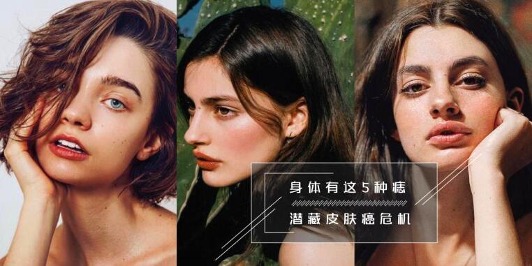 25岁后才生长的痣可要注意 身上若有这些痣患上皮肤