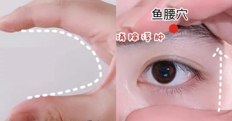 眼皮下垂怎么自然恢复？内双变外双眼周按摩法，拯