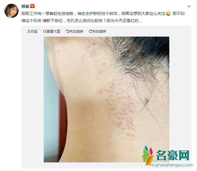 杨紫回应整容传闻