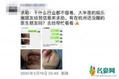 网曝范丞丞洗澡摔倒 下巴伤口明显惹粉丝心疼