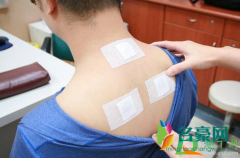 三伏贴第一贴和第二贴隔多久 三伏贴的注意事项