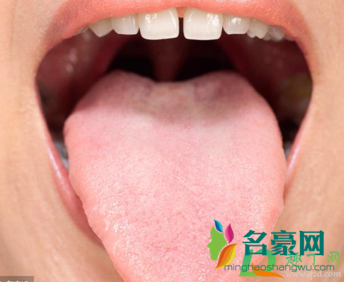 舌苔发黄是什么原因引起的3