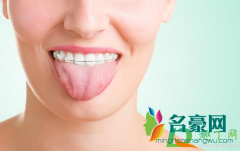 舌苔发黄是什么原因引起的 舌苔发黄怎样恢复正常