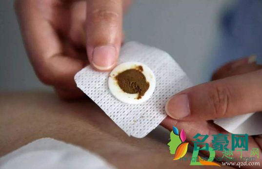 三伏贴生病期间可以贴吗3