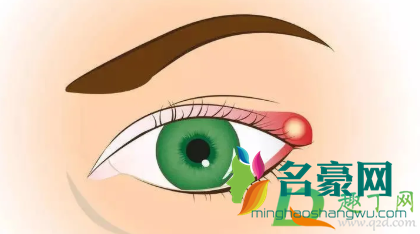 眼睛部位长针眼疼怎么缓解4
