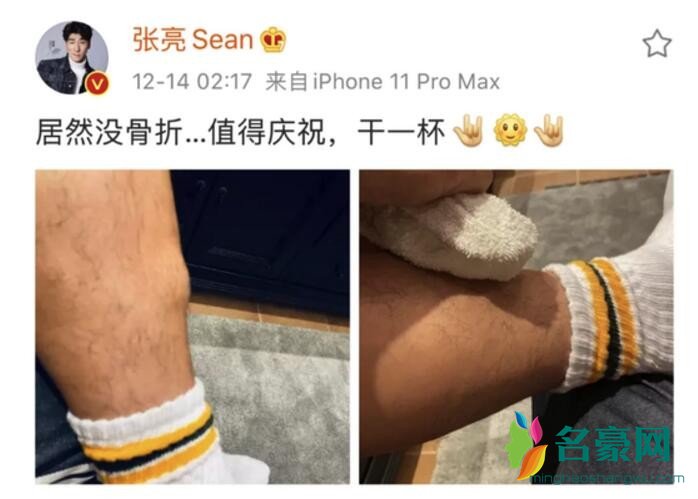张亮晒受伤照被骂