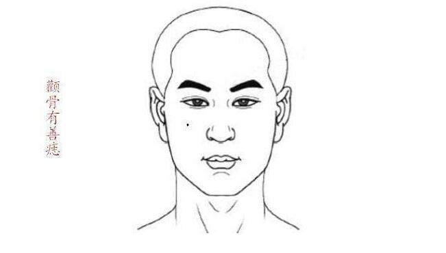 右脸颧骨长痣