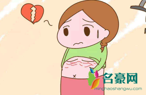 妊娠纹不退好闹心！真的没有办法去除吗？2
