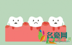 牙龈出血什么办法可以止血 牙龈出血是上火引起的