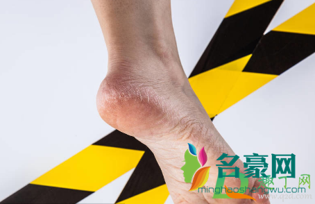 为什么一到冬天手脚就裂开3