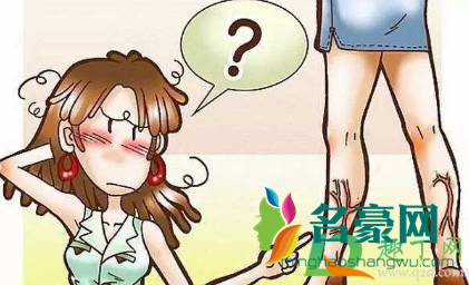 静脉曲张需不需要做手术1