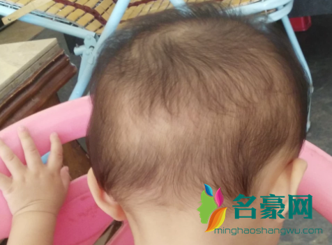 宝宝头发稀少急死妈！剃了就会越来越密?2