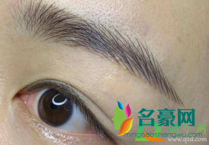 有几根眉毛变白是什么原因3