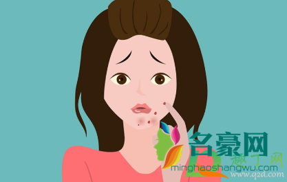 内分泌失调怎么调理脸上长痘痘2