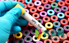 HPV是什么 HPV怎么检查