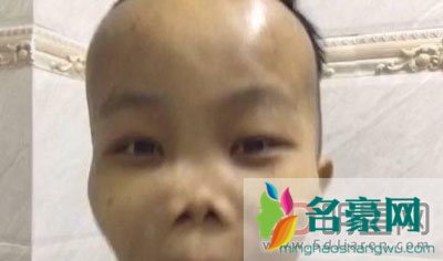 陈山是不是死了 他身边的女人也就是看他有钱冲着钱去的