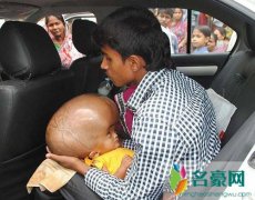 罗娜·贝古姆现状几岁了 看着她都觉得她好痛苦为什