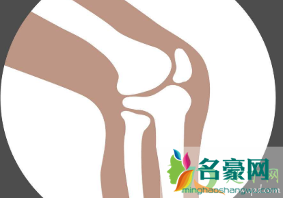 膝盖骨折要打钢钉吗3