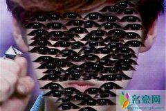 张翰的眼睛恐惧症 这个眼睛感觉跟青春痘似的可以