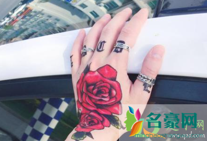手背小红点不痛不痒是怎么了1