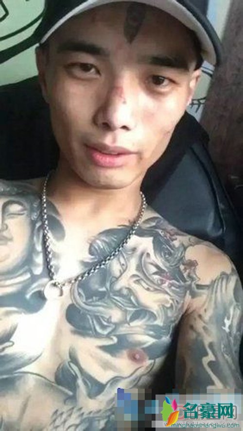 红番区三眼张佳玮被砍 快手三眼鼻子被谁砍了