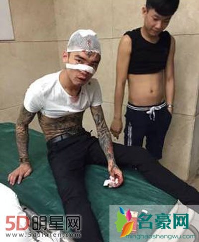 沈阳红番区三眼张佳玮快手号多少及个人资料 三眼被谁砍的