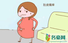 孕期肚子痒一定是长妊娠纹吗 孕期胆汁淤积症表现