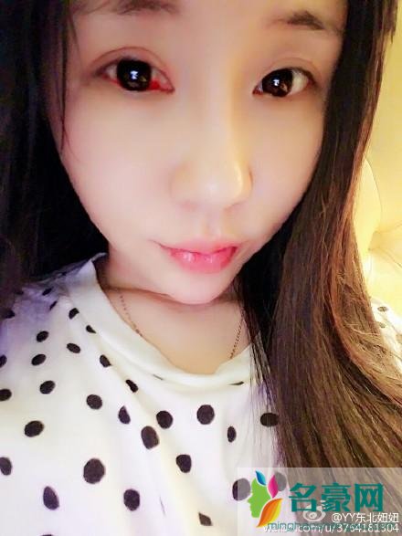 王小源睡过东北妞妞吗 东北妞妞整容前后照片对比