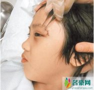 费曼的眼睛怎么弄伤的 为何网传和曹格儿子有关
