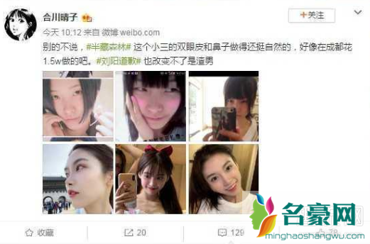 半藏森林整容了吗 半藏森林整容前是什么样子