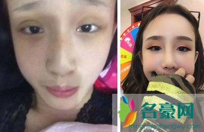 马僖嘉跟多少人睡过黑历史曝光 马僖嘉整容前后照片