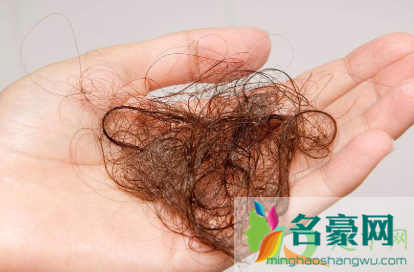 掉头发是什么原因女性4