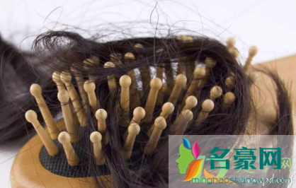 掉头发是什么原因女性2