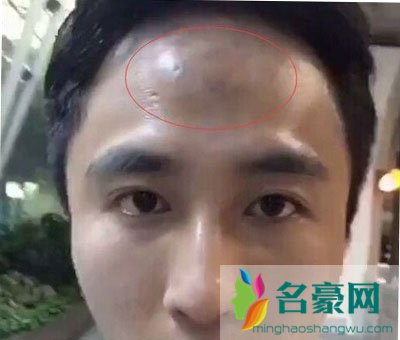 天佑和散打哥哪个厉害谁有钱 天佑为什么骂散打哥