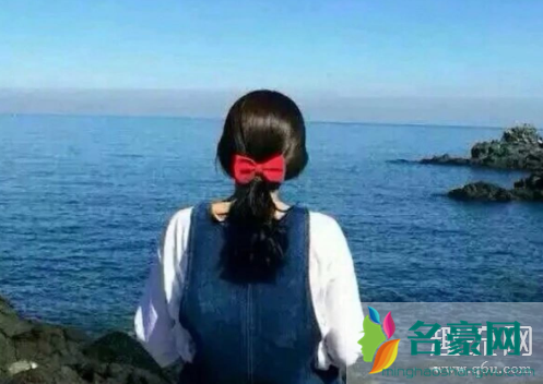 发际线后移怎么办 如何避免做秃头少女