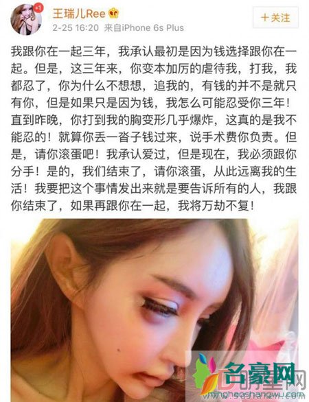 王瑞儿自曝遭家暴 伤痕累累宣布分手