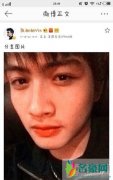张彬彬整容前后照片 觉得他古装特别符合古言小说