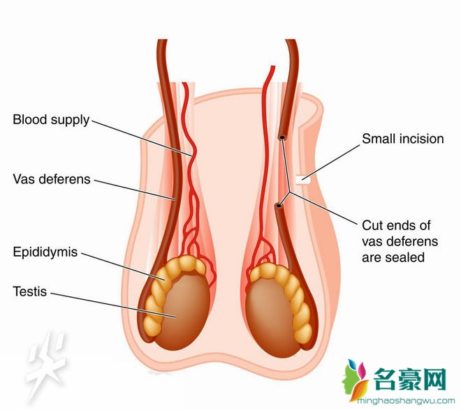 跑步磨蛋怎么办 跑步时蛋蛋摩擦怎么办