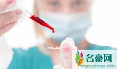 血液是红色的为什么血管是蓝色的 血液血管在人体