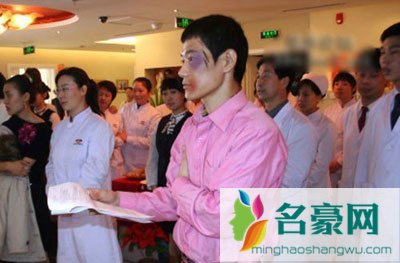 天天向上浩二被打了 天天向上浩二怎么了