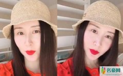 舒畅近照曝光 她的脸型变长被质疑整容过度造成