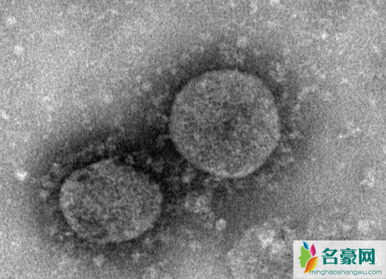 新型冠状病毒突变会怎么样 新型冠状病毒突变丧失听力味觉是真的吗
