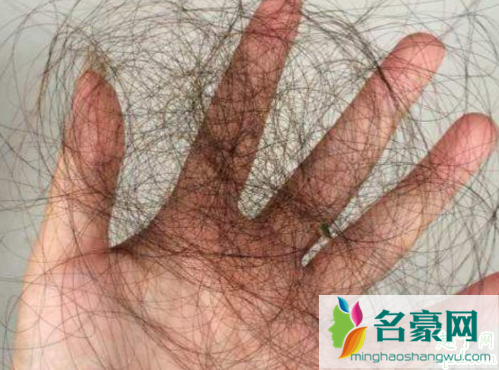 哺乳期掉头发是气血不足吗 气血不足脱发怎么调理3